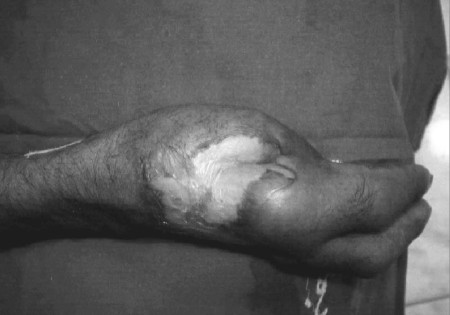 Fig. 2a Case 2, pre-op.