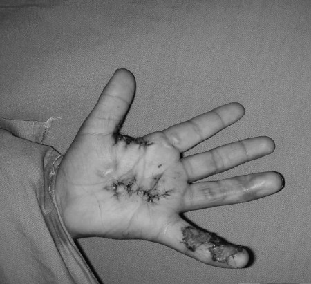 Fig. 3aCase 3, pre-op.