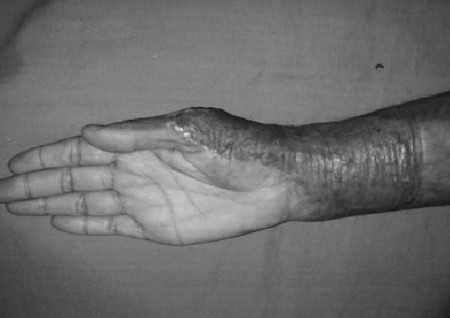 Fig. 6cCase 6, post-op.