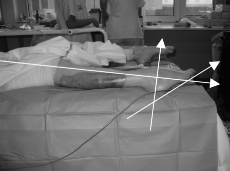 Fig. 1Equin mesur� � 60�.