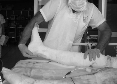 Fig. 6 Mobilit� passive en flexion dorsale�de 2�.