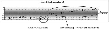 Graphique III Mesure de l��quin, cas clinique n� 3.