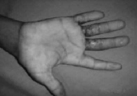 Fig. 5cCase 5, post-op 2.