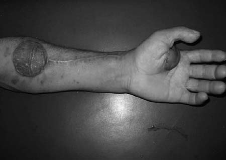 Fig. 4cCase 4, post-operative.