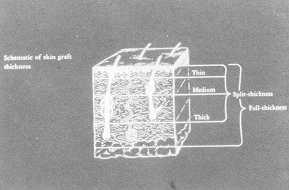 gr0000003.jpg (5508 byte)