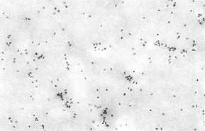 Fig. 4 Aggregates of peripheral blood leukocytes shortly after. admission