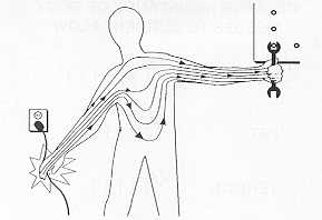 Fig. 9 Current lines through body if current passes arm-to-arm