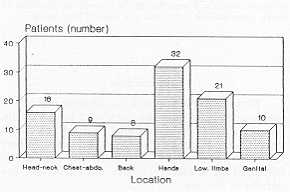 Fig. 5 Location of bums