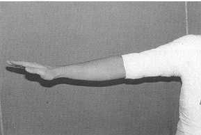 Fig. 4 Appareil thoraco-brachial