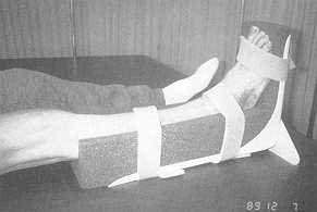 Fig. 8 Orth&se de position pour la cheville et le pied