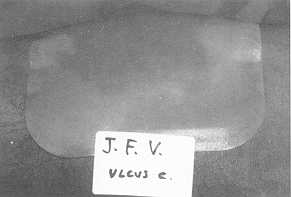 Fig. 1b Intraoperative appearance of the dressing