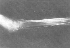 Fig. 4 Arteriographic study