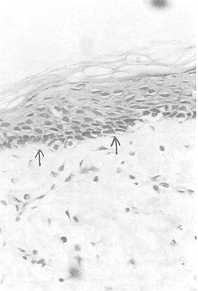 Fig. 7 The four dayers of the capsule (haematoxylin and eosin stain).