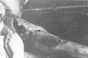 Fig. I Femorogluteal injury treated with epidermodermic transplant (mesh graft x 4).