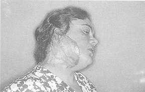 Fig. 2c Appearance after 5 months.