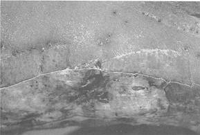 Fig. 7 (B) Patient 5 - 19 days after operation partially epithelialized skin was shown.