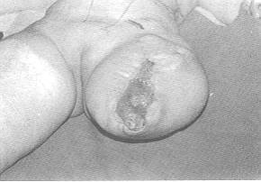 Fig. (2-A)