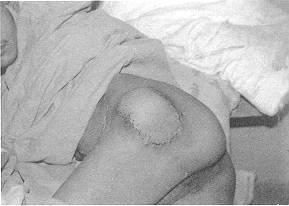 Fig. (I-B)