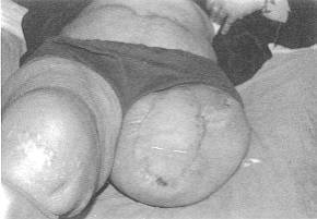 Fig. (2-B)