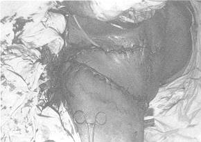 Fig. (3-B)
