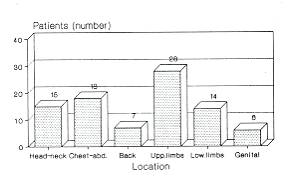 Fig. 7 Location of burns.