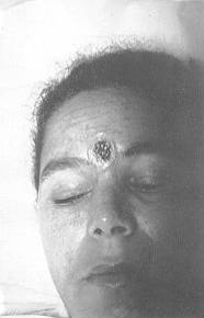 Fig. 4 Control after 10 days of treatment.