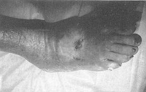 Fig. 8 Control after fifth application