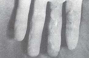 Fig. 4 - Late results.