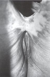 Fig. 3b - Vue propratoire postrieure. 