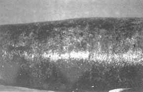 Fig. 1 - An early excised deep burn in the leg. Biobrane covering the wound. 