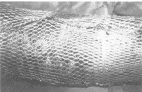 Fig. 3 - Bed grafted with a 3:1 mesh graft.