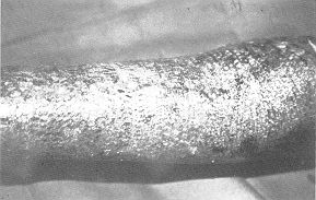 Fig. 5 - Seven days after grafting. Mesh closing beneath Biobrane. 
