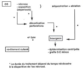 Fig. 1 - Technique de la décortication osseuse des os longs.