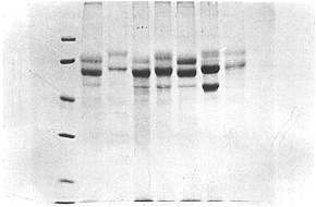 Fig. 2 - SDS-PAGE of keratins isolated from epidermis of normal (lanes 2, 3, 8), HTS (4, 5, 6) and keloid (lane 7) Marker proteins (lane 1). (a) phosphorylase-13 (97,400); (b) bovine serum albumin (67,000); (c) ovalburnin (43,000); (d) carbonic anhydrase (30,000); (e) trypsin inhibitor (20,000).