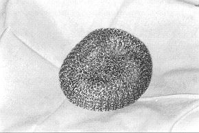 Fig. 1 - The metallic swab