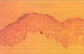 Fig. 7Vertical section of the RHPS.<br>&nbsp;