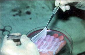 Fig. 8Petri dish containing RHPS which has skin-like consistency and thus is easy to handle.