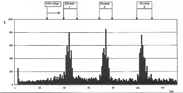 Fig. 1Model graph to demonstrate the hourly diuresis of a patient with burns on 30-40 % of the body surface. In the initial stage the diuresis is limital, the values are almost stable. Then starts the preparatory stage and shock is terminated by potent diuresis. Later periods with high and optimal diuresis alternate throughout the period of treatment at the intensive care unit.