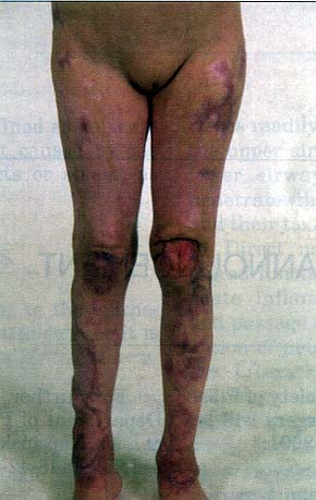 Fig. 7a
