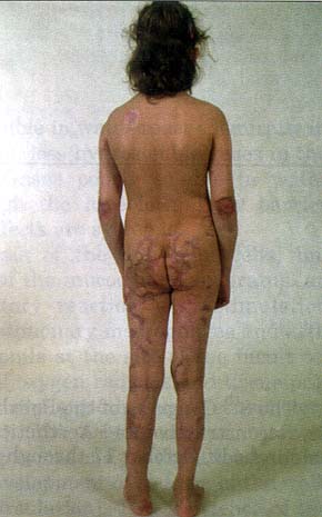 Fig. 7b