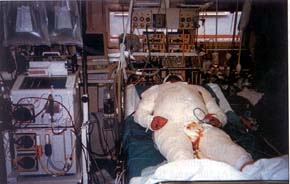 Fig. 1treatment of a patient in critical condition with burns.
