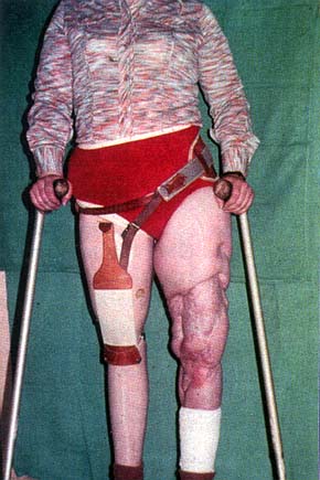 Fig. 2In contrast, this 20-year-old girl, severely disabled following a train accident, started to work again as a radio reporter.