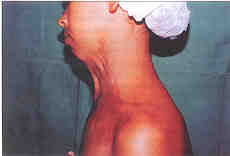 Fig. 1B)