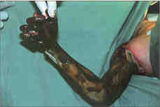 Fig. 4A)