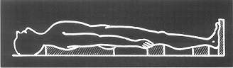 Fig. 12
