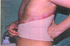 Fig. 18