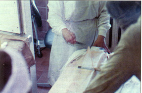Fig. 1 Collection of a xenogenic dermo-epidermal graft performed by the author in the laboratory for production of transplants, Ufa, June 1989. Further processing of grafts in laminate box (left corner) for use in the Republican Children Hospital, Ufa
