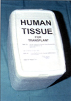 Fig. 2a