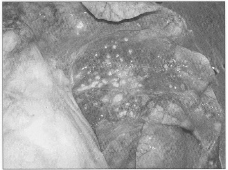 Fig. 5The brain - histology