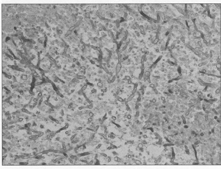 Fig. 7Lungs - histology